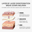 Whitening Freckle Face Cream for Melasma