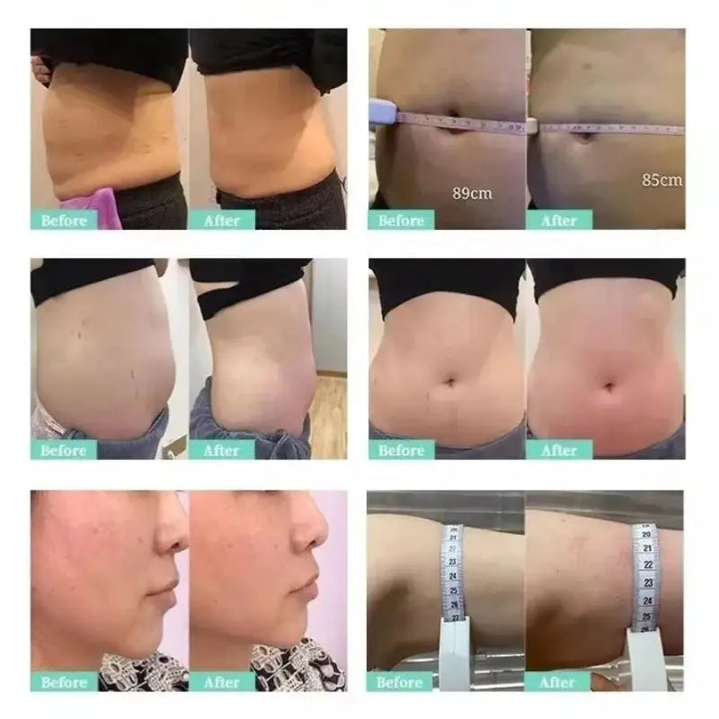 Body Shaping Slimming Machine Fat Reduction Equipment for Beauty Salon Spa Weight Loss Body Contouring and Shaping Treatment