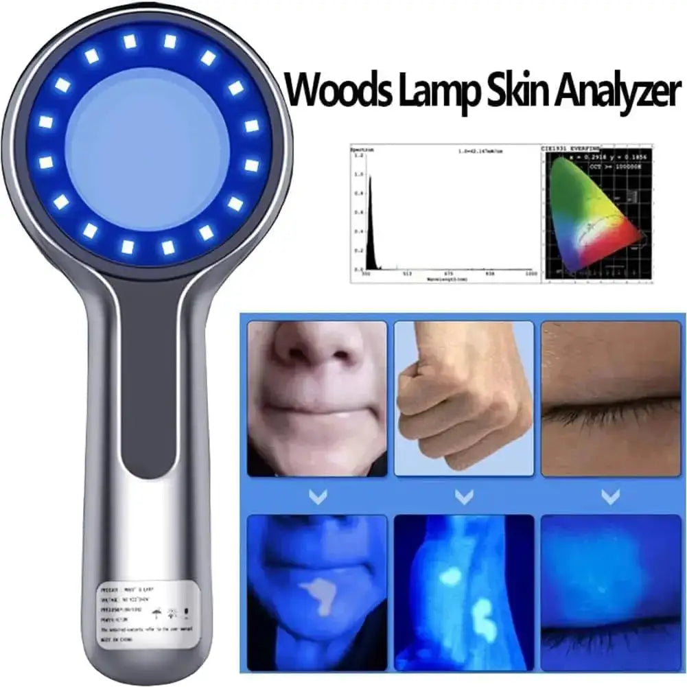 Woods Lamp Skin Analyzer UV Light Magnifying Glass Facial Skin — product view 6