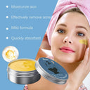 Oil Control Acne Face Cream Hydration