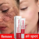 Whitening Cream for Women Fade Melasma