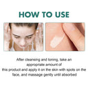 Brightening Melasma Cream for All Skin