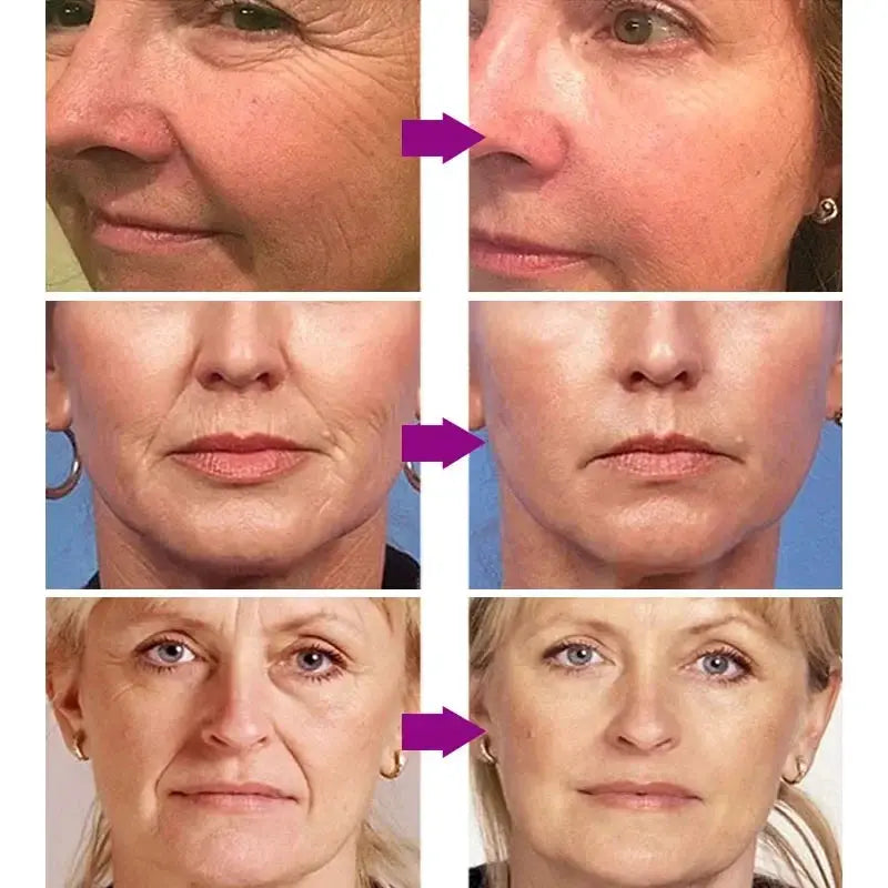 Retinol Wrinkle Remover Face Serum Instant Firming Lifting