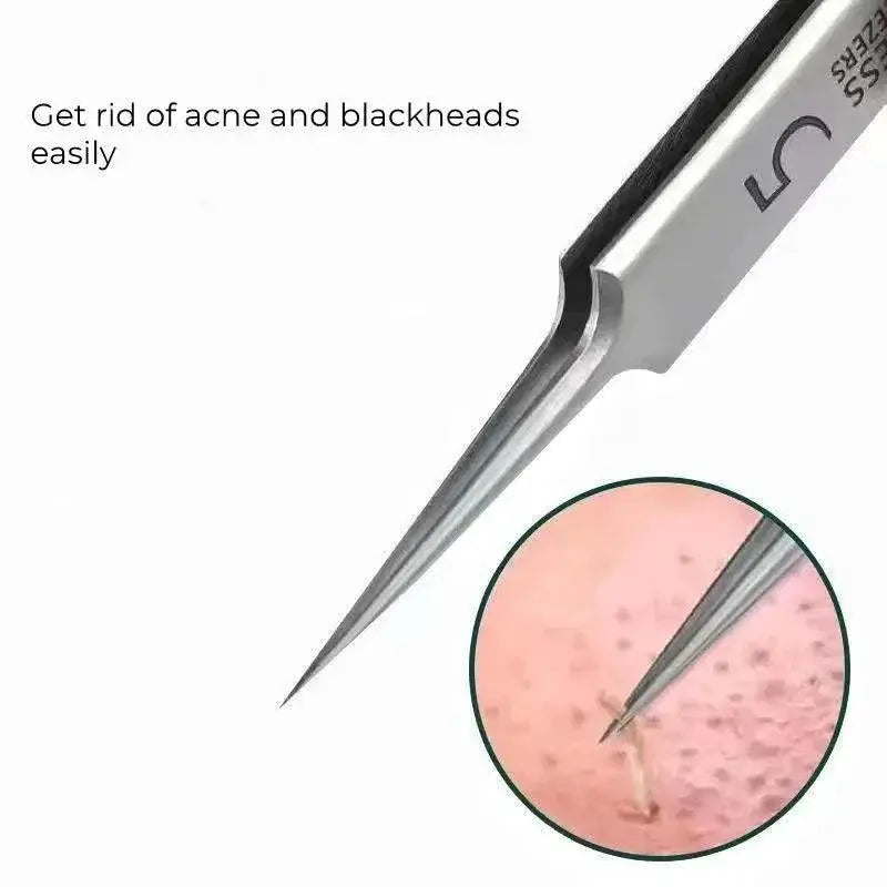Ultimate Blackhead Removal Kit for Clear Radiant Skin