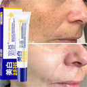 LAIKOU Whitening Spot Removing Cream For Dark Spots Melasma Brightening