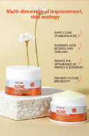 Oil Control Acne Cream for Clear Skin