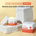 Oil Control Acne Cream for Clear Skin