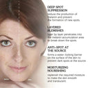 Whitening Freckles Face Cream For Melasma Dark Spots Removal And Anti Aging