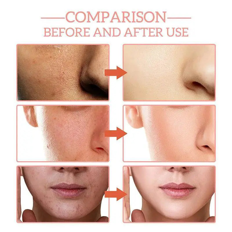 Hyaluronic Acid Anti Wrinkle Serum For Glowing Skin Daily