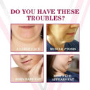 V Line Face Lifting Cream For Women