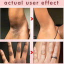 Brightening Cream for Private Areas