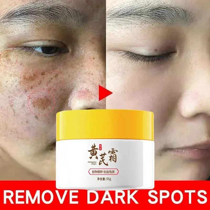 Astragalus Whitening Freckles Face Cream Remove Dark Spots Melasma Lighten Melanin Acne Scars Anti-aging Brighten Skin Care 55g