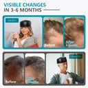 Red Light Therapy Helmet Anti Hair Loss Cap for Men
