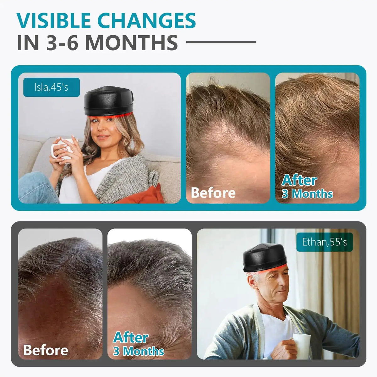 Red Light Therapy Helmet Anti Hair Loss Cap for Men — product view 2