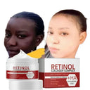 Facial Whitening Cream for Dark Spots