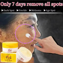 Whitening Freckle Face Cream for Melasma