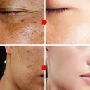 Freckle Cream For Brighter Skin