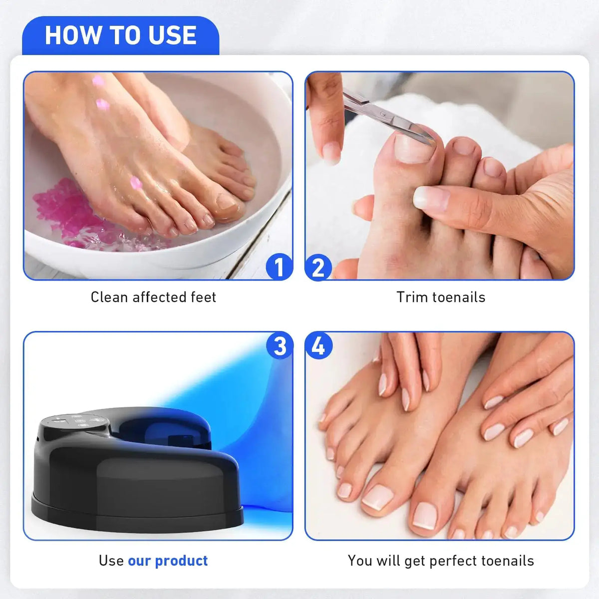 Wireless Nail Fungus Cleaning Device for Toenails & Fingernails — product view 6