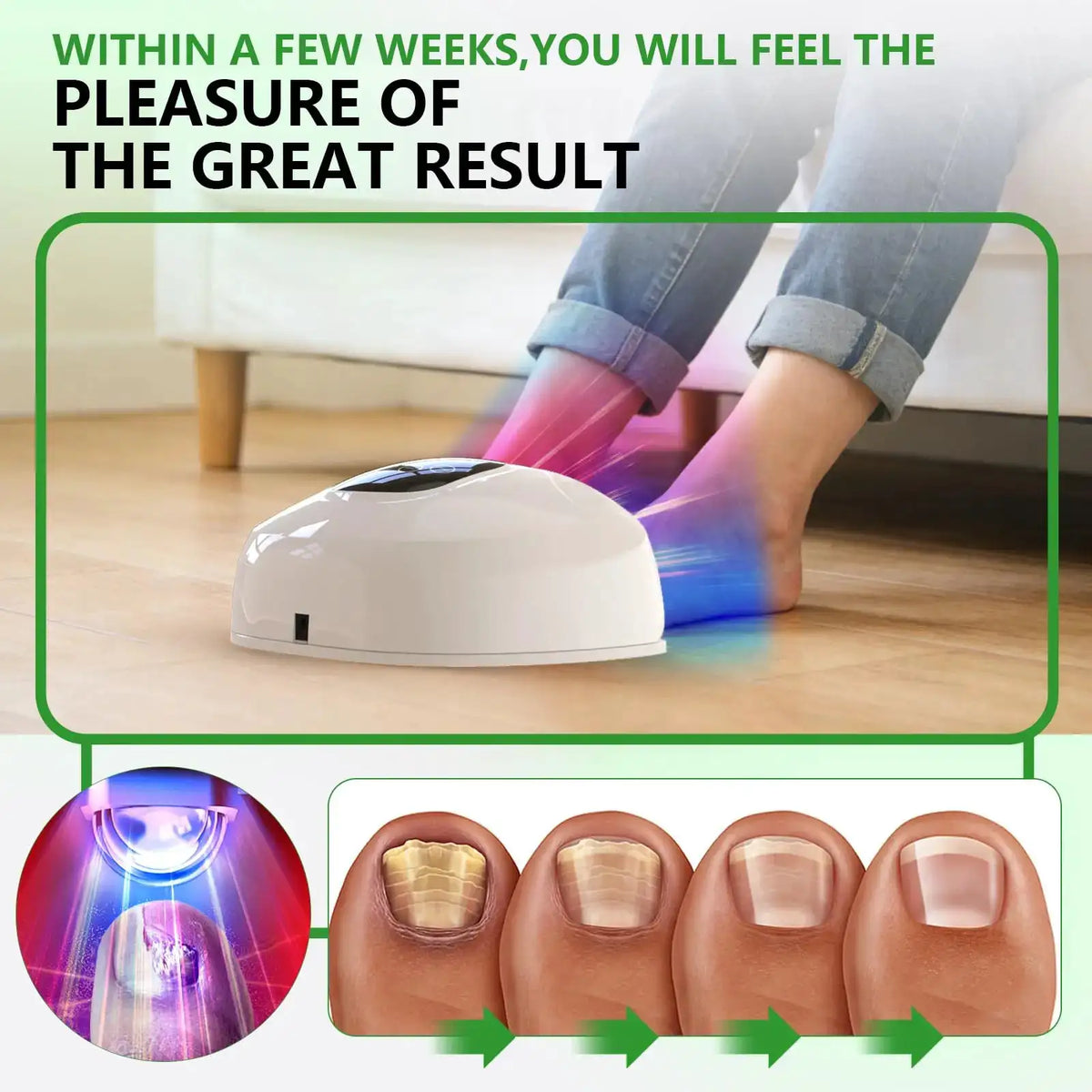 Nail Fungus Treatment Light Device Set Timer Dimming Phototherapy — product view 5