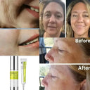 Retinol Eye Cream Set For All Skin Types