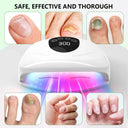 Nail Fungus Treatment Light Device Set Timer Dimming Phototherapy