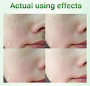 Pore Tightening Cream for Large Pores