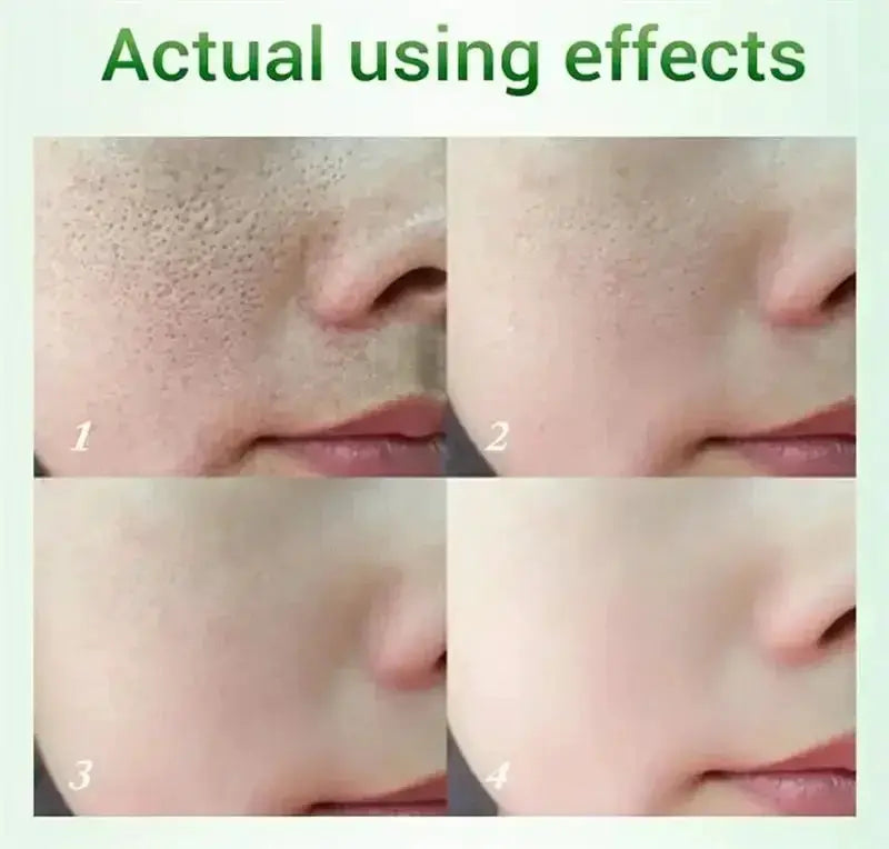 Salicylic Acid Pore Shrinking Cream Quick Elimination Large Pores Remove Blackehead Tighten Face Smooth Skin Care Products 2024
