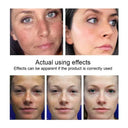 Anti Aging Cream For Mature Skin Lifts