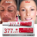 Powerful Spot Removing Whitening Cream for Dark Spots and Melasma