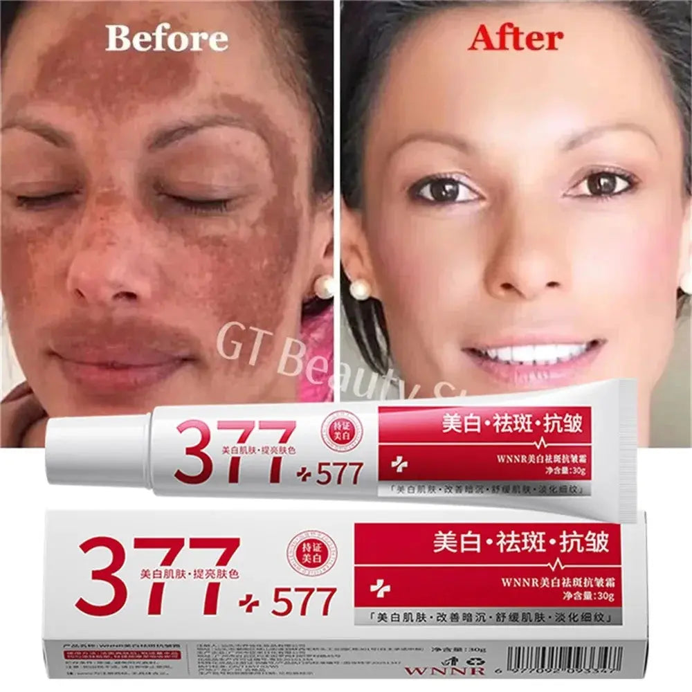 Powerful Spot-Removing Whiten Cream Brighten Skin Fast Eliminates Melanin Pigmentation Melasma Dark Spots Korean Face Skin Care