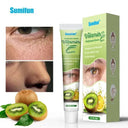 Eelhoe Fat Granules Remover Eye Cream Unisex Whitening 20ml