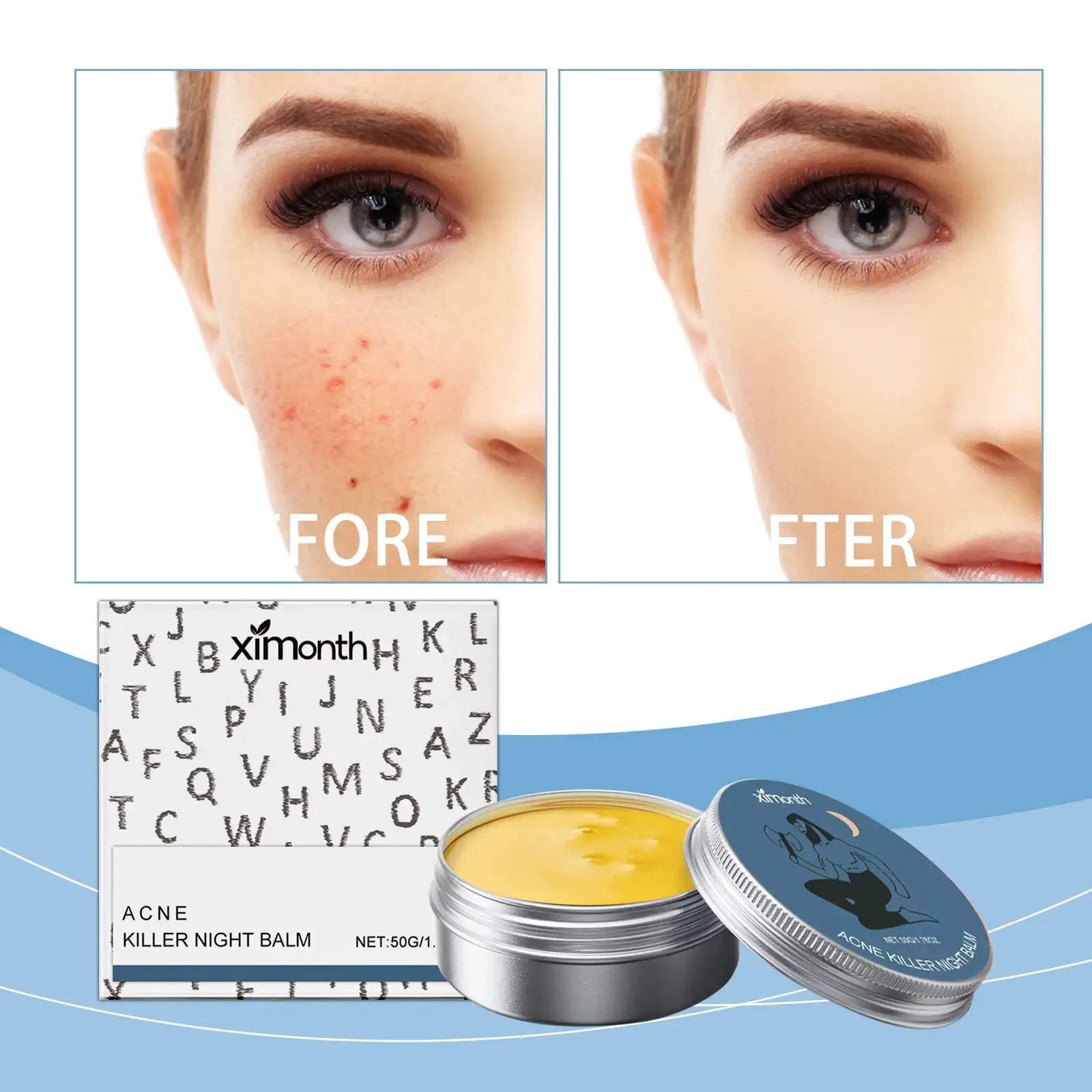 Acne Removal Face Cream Gently Balances Skin Oil Refreshing Skin Care Shrink Pores Oil Control Hydrating Anti Acne Cream