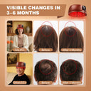 Red Light Therapy Hair Care