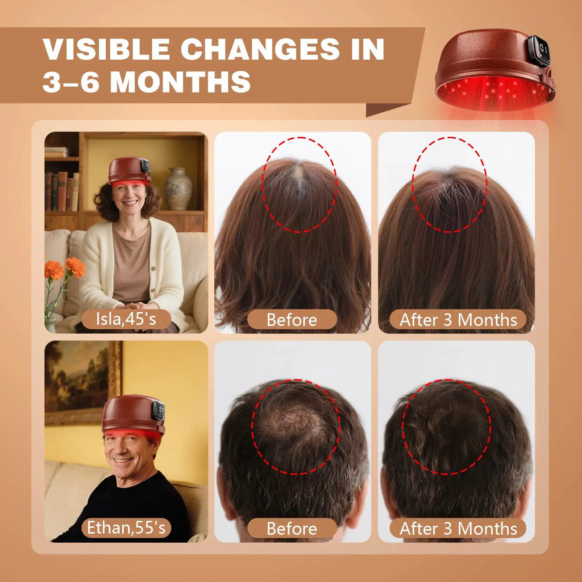 Red Light Therapy Hair Growth Cap Infrared LED Lights Hat — product view 7