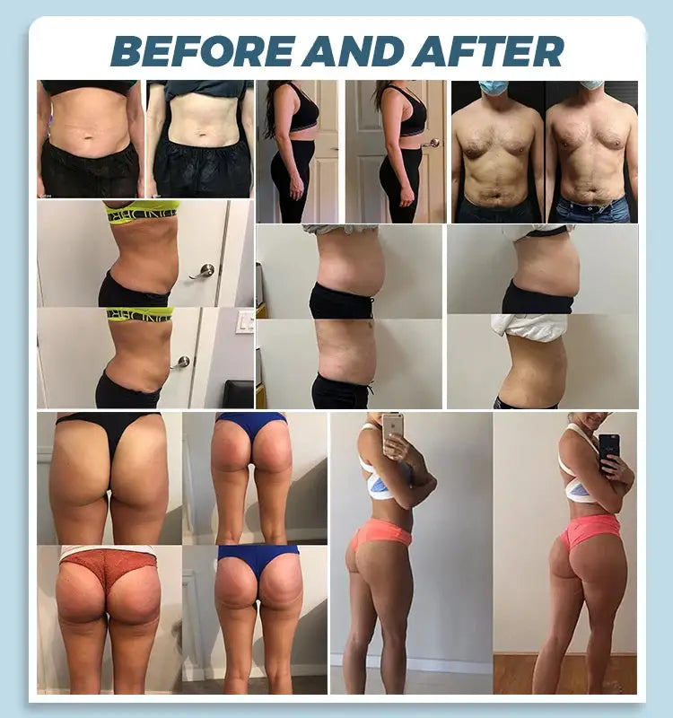 MYOslim Muscle Stimulator Body Sculpting Machine EMS Body Toning Ab Trainer Buttock Lifter Fat Burning for Gym Beauty Salon