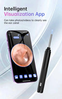 Ear Wax Endoscope for Safe Home Cleaning