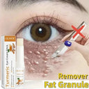 Firming Eye Roll On For Puffiness Now