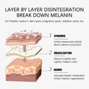 Brightening Melasma Cream for All Skin