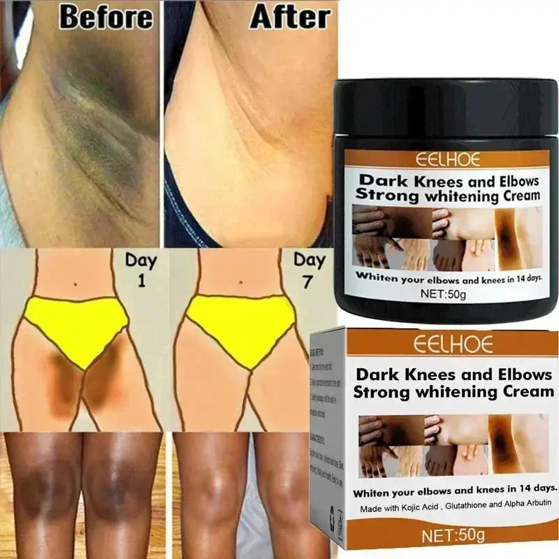 Dark Knuckles Fast Brighten Cream Elbows Hand Knuckle Brightening Serum Knee Black Skin Quickly Lighten Stains Remover Products