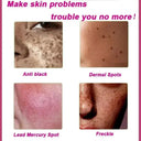 Freckle Cream For Brighter Skin