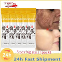 Freckle Cream For Brighter Skin