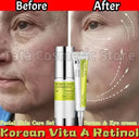 Retinol Eye Cream Set For All Skin Types
