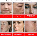 Whitening Cream for Women Fade Melasma