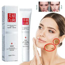 Brightening Cream For Women Freckles