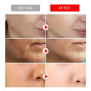 Anti Aging Cream For Mature Skin Lifts