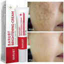 Whitening Freckles Face Cream For Melasma Dark Spots Removal And Anti Aging