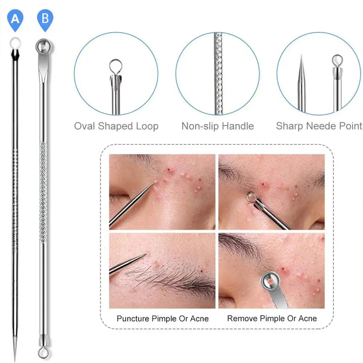 Acne Needle Blackhead Remover Set 4pcs Comedone Kit