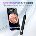 Ear Wax Endoscope for Safe Home Cleaning