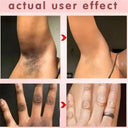 Brightening Cream for Private Areas