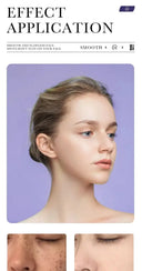 Brightening Niacinamide Cream for All